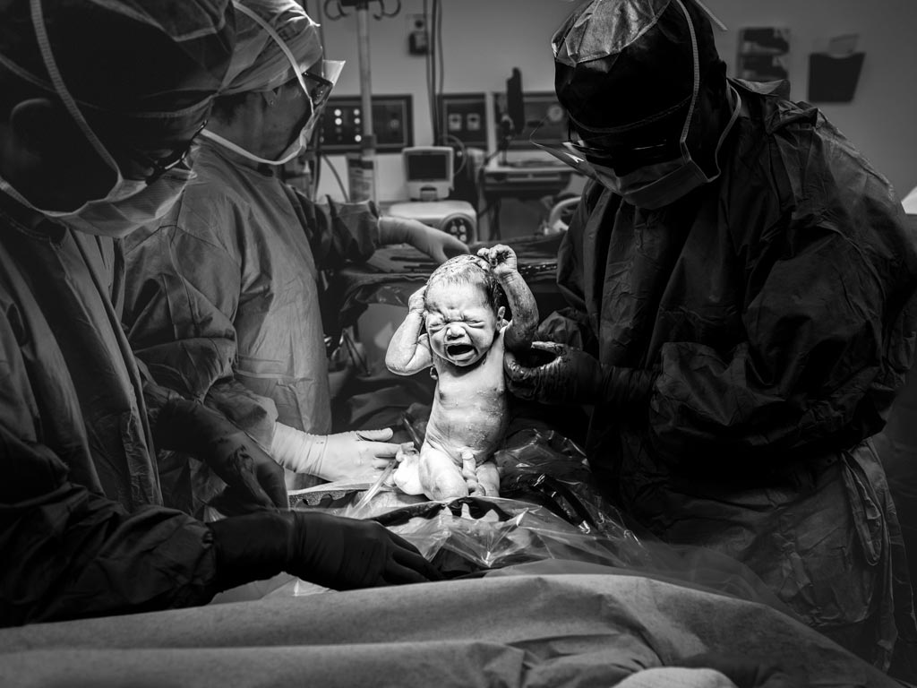 baby-being-birthed